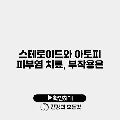 스테로이드와 아토피 피부염 치료, 부작용은?