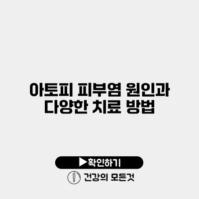 아토피 피부염 원인과 다양한 치료 방법